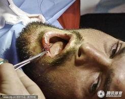 破嘴图片,揭秘幽默与尴尬的瞬间